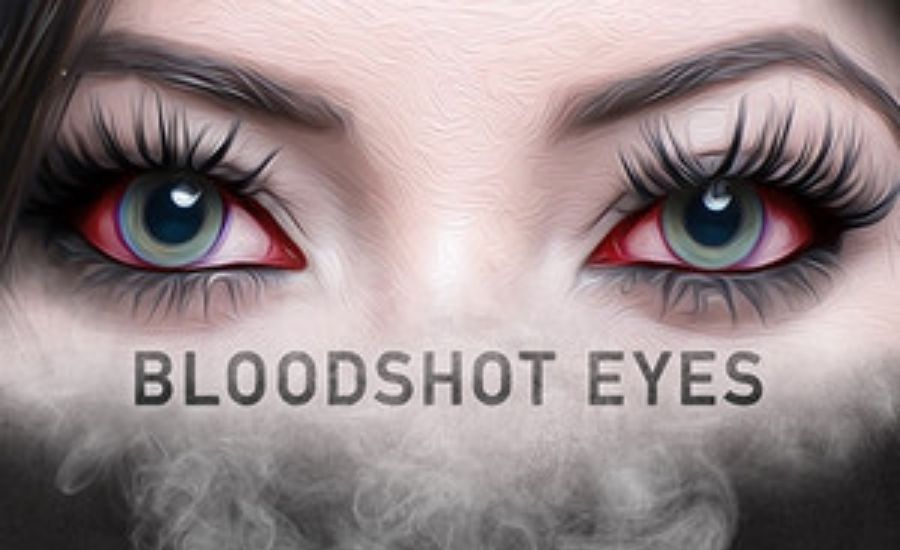 The Impact of Digital Trends on the Popularity of “Its Eyes Are Bloodshot”